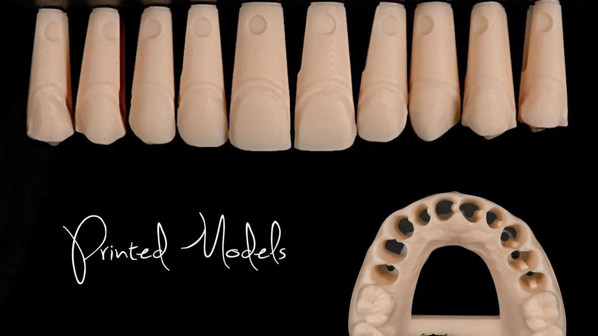 A row of 3D printed removable dies and a printed arch